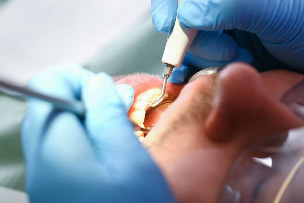 Best Dentist for Tooth Abscess  in Norris City, IL