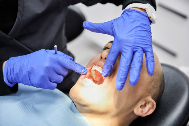 Best Knocked-Out Tooth Emergency  in Norris City, IL