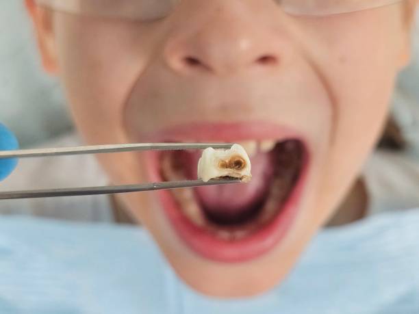 Best Broken Tooth Emergency  in Norris City, IL
